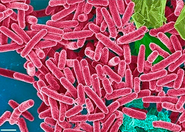 Pseudomonas aeruginosa es una bacteria presente en el ambiente, patógena para el humano y otros mamíferos. 
