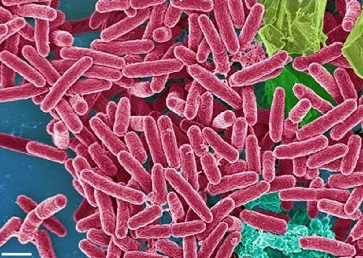 Бактерия синегнойная палочка. Псевдомонас аэругиноза. Псеудомонас бактерия. Бактерии псевдомонас.