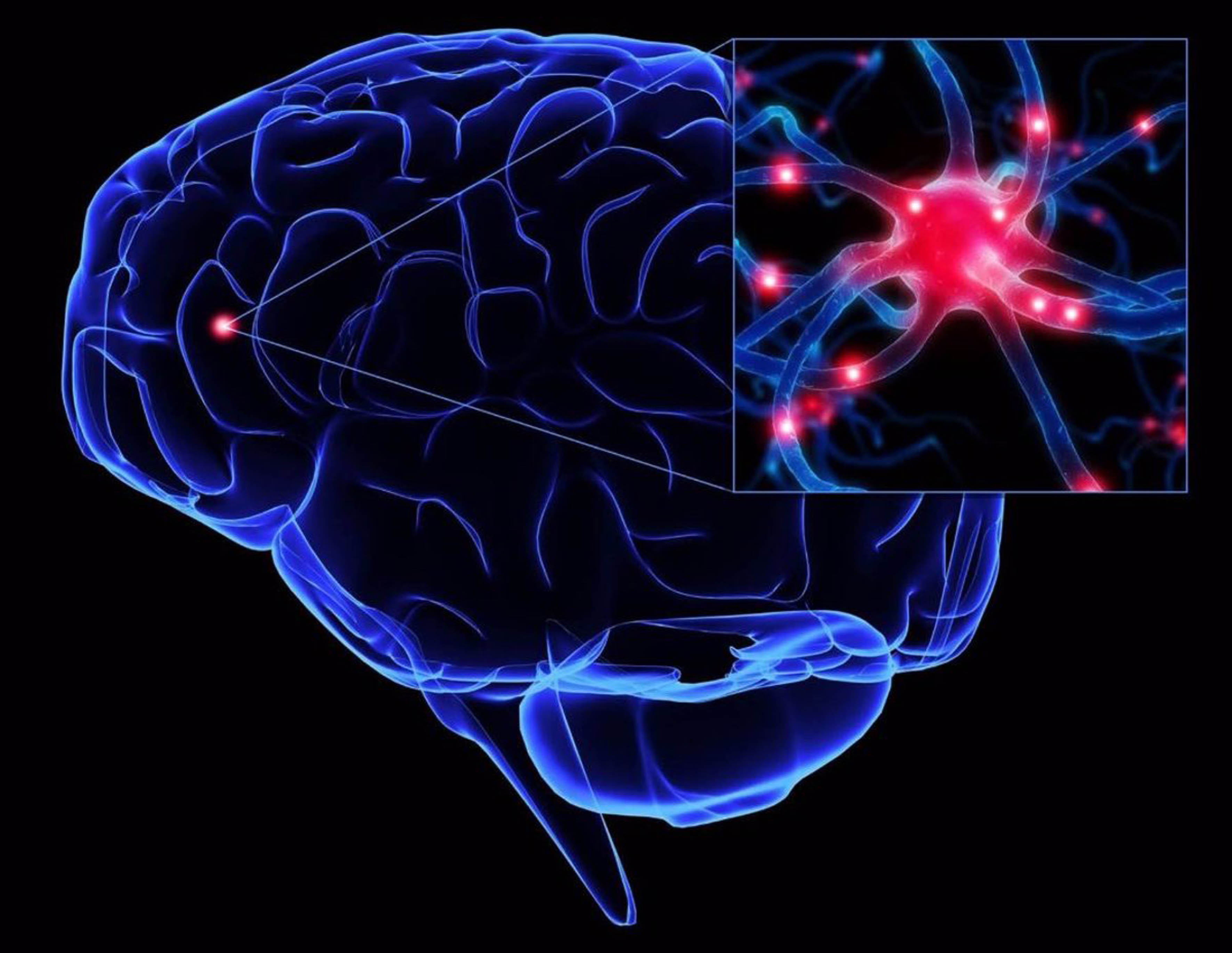 Diagnóstico temprano, principal reto ante el mal de Parkinson